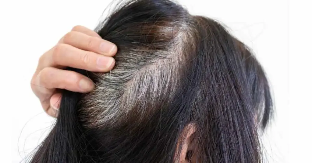 News Telugu: Hair Care: చిన్న వయసులోనే జుట్టు తెల్లబడుతుందా?