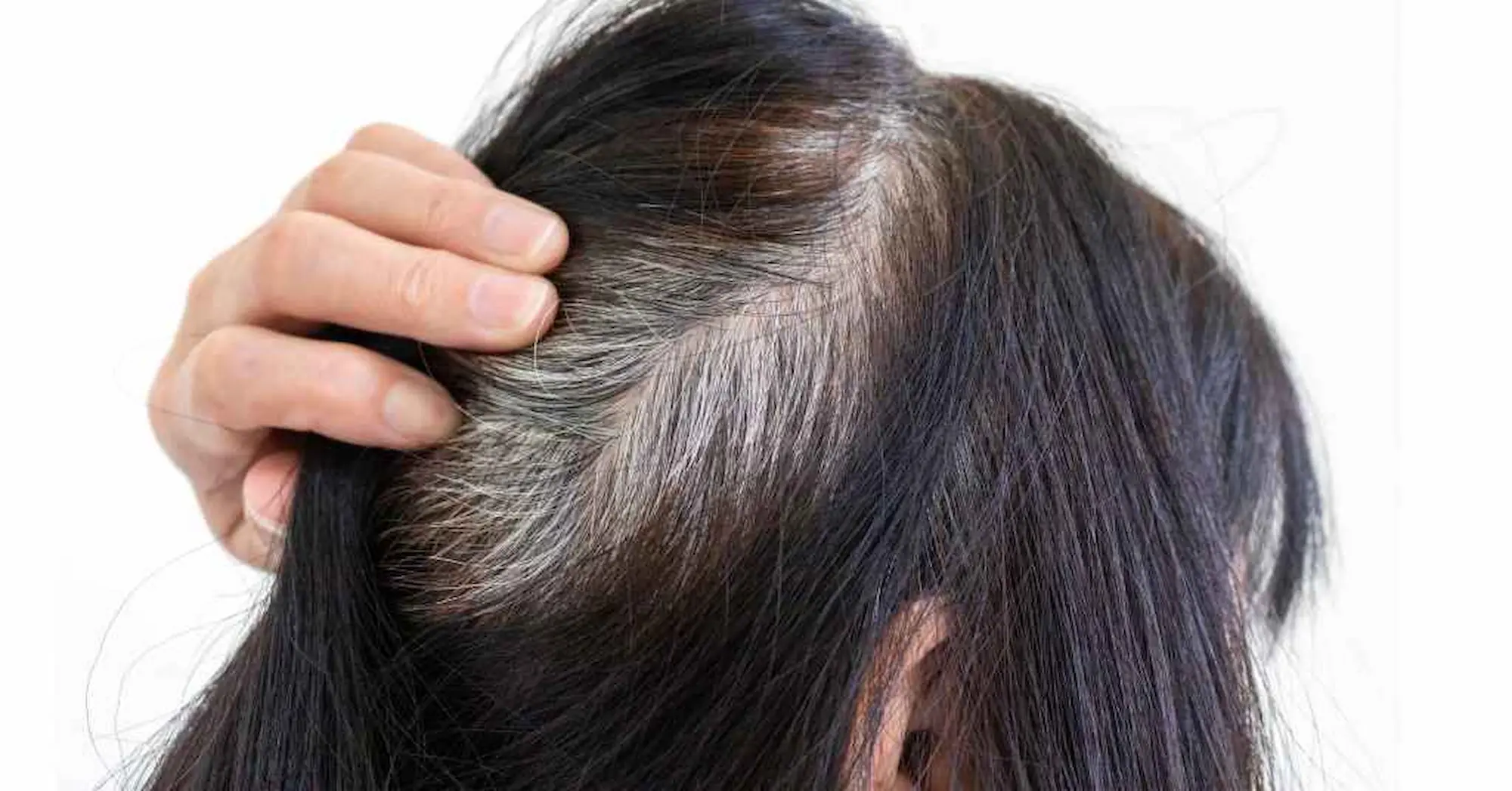 Hair Care: చిన్న వయసులోనే జుట్టు తెల్లబడుతుందా?