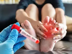 యూరిక్ యాసిడ్ సమస్యకు పరిష్కారం తెలుసుకుందాం..