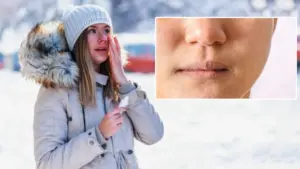 చలికాలం లో చర్మం సాఫ్ట్‌గా ఉండాలంటే?