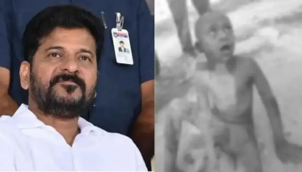 Latest News: CM Revanth: వీధి కుక్కల దాడిలో గాయపడ్డ బాలుడు.. స్పందించిన సీఎం