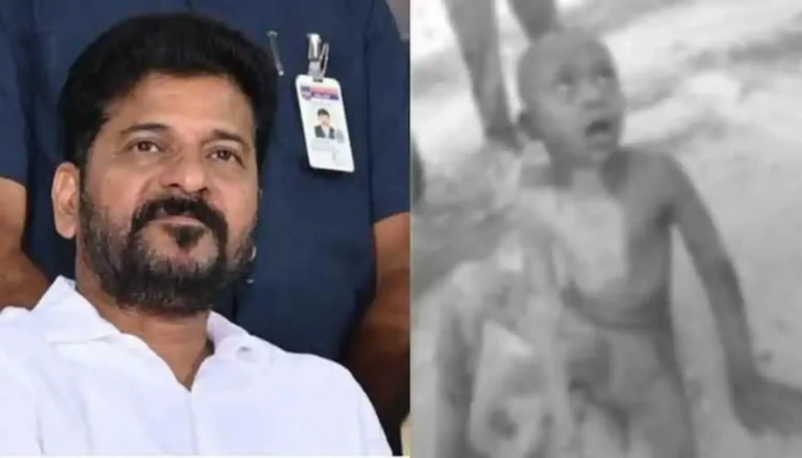 Latest News: CM Revanth: వీధి కుక్కల దాడిలో గాయపడ్డ బాలుడు.. స్పందించిన సీఎం