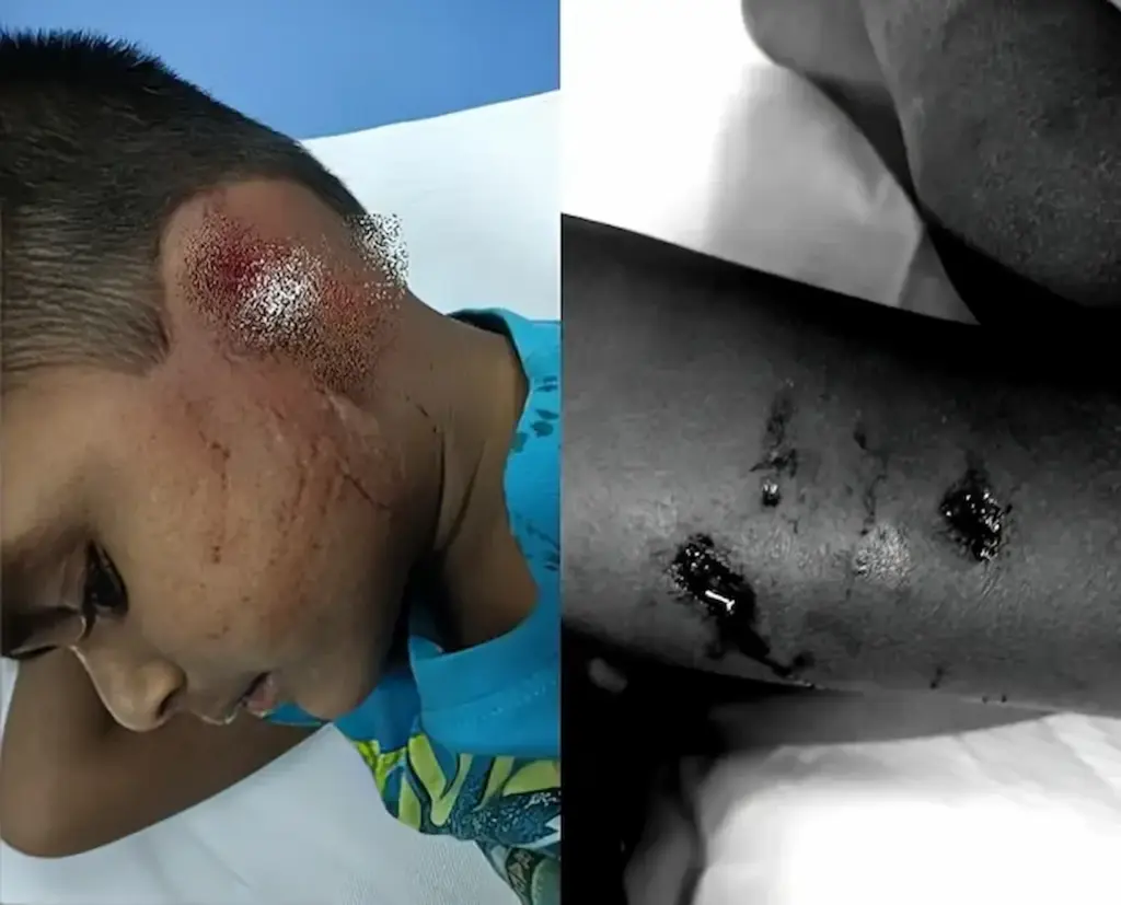 Latest News: AP Crime: ఘోరం.. బాలుడి చెవి కొరికేసిన కుక్క