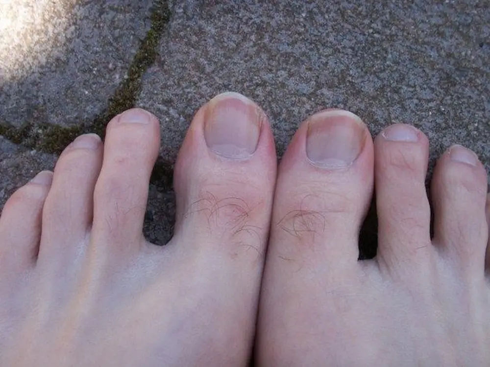 Do you know what the hair on your toes