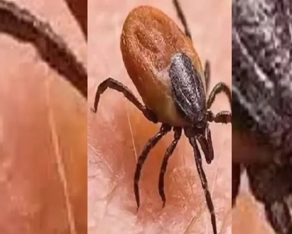 AP: Six-year-old girl tests positive for scrub typhus