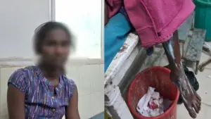 హనుమకొండలో నర్సింగ్‌ విద్యార్థినిపై కెమికల్ దాడి కలకలం