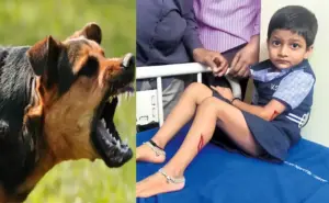 కుక్కకాటు భయాందోళన.. రోజుకు 300 మందికి పైగా ఆస్పత్రికి క్యూ