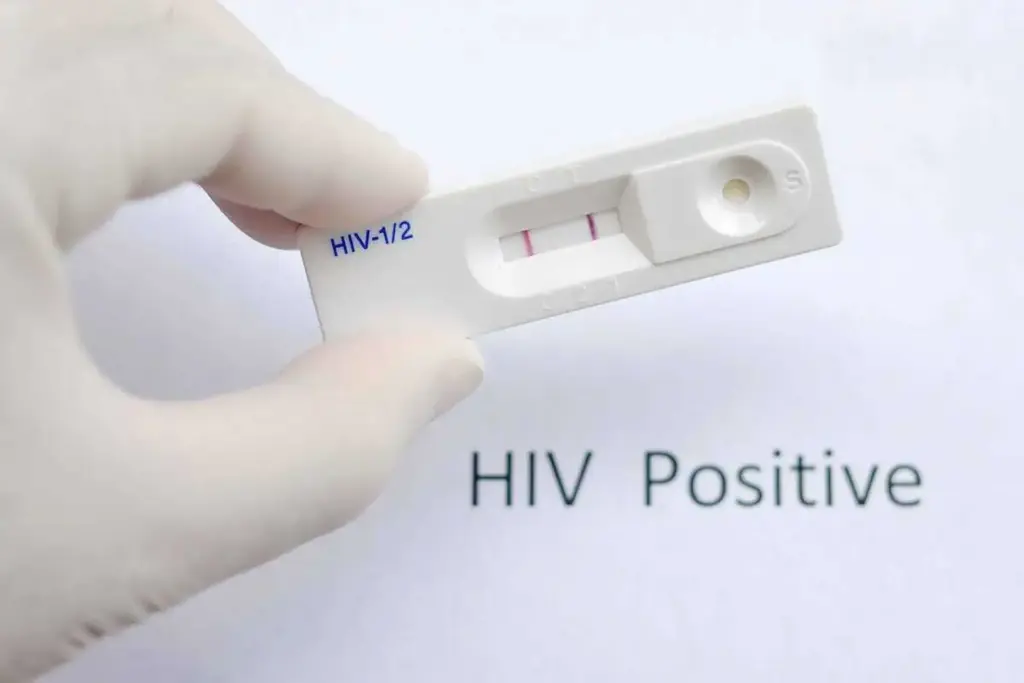 7400 HIV cases in a single district