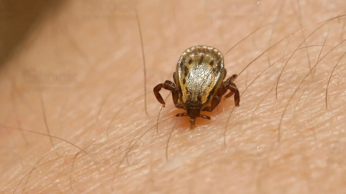 Scrub typhus: జుళిపిస్తున్న “స్క్రబ్‌ టైఫస్‌”..ఐదుకి చేరిన మృతుల సంఖ్య