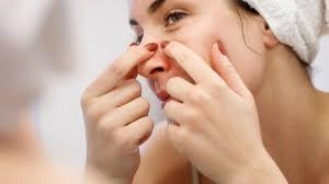 మొటిమలు సూచించే శరీర సమస్యలు