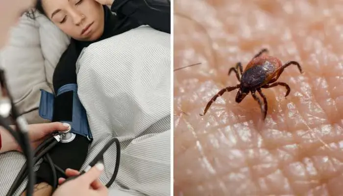 Telugu news: Scrub typhus: పిహెచ్ సి స్థాయిలోనే స్క్రబ్ టైఫస్ నిర్ధారణ పరీక్షలు