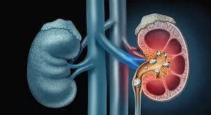 Kidney health