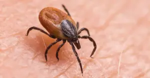 ఆరేళ్ల బాలికకు స్క్రబ్ టైఫస్ పాజిటివ్