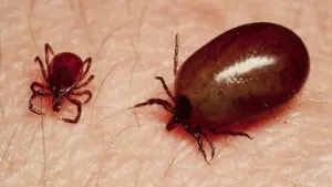 ఆంధ్రప్రదేశ్‌లో విజృంభిస్తున్న స్క్రబ్ టైఫస్ వ్యాధి