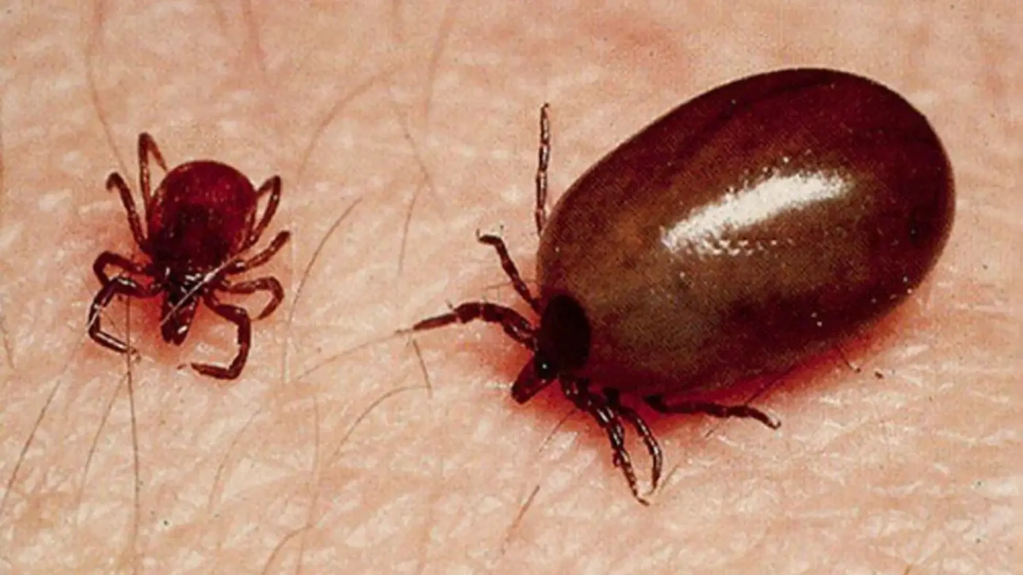 AP: ఆంధ్రప్రదేశ్‌లో విజృంభిస్తున్న స్క్రబ్ టైఫస్ వ్యాధి