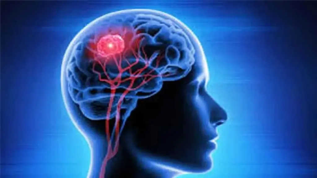 Neurological diseases