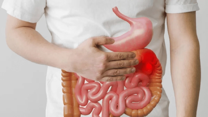 Gut Health: పేగులు ఆరోగ్యంగా ఉండాలంటే ఇవి తీసుకోండి
