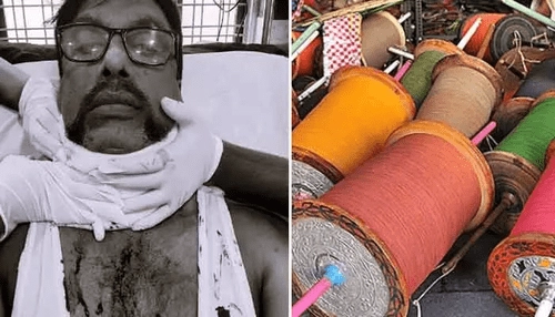 Uppal: హైదరాబాద్‌లో ASI నాగరాజు పై చైనా మాంజా ప్రమాదం.. హాస్పిటల్‌లో చికిత్స