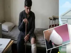 తన కాలును తానే నరుక్కున్న యువకుడు.. ఎందుకో తెలుసా?