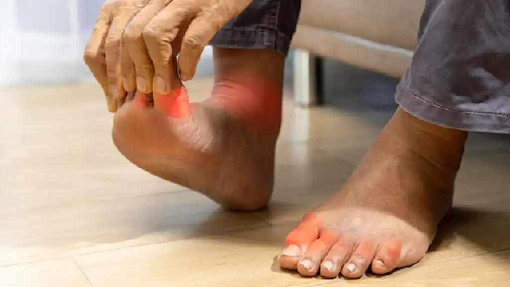 తరచూ పాదాల్లో మంటలు.. షుగర్ వ్యాధికి సంకేతమా?