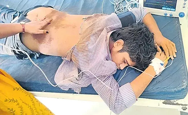 Palnadu crime: బస్సు ప్రమాదంలో 16 ఏళ్ల విద్యార్థి మృతి