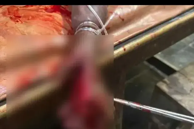 Lepakshi crime: Man attacked with machete for asking him to slow down