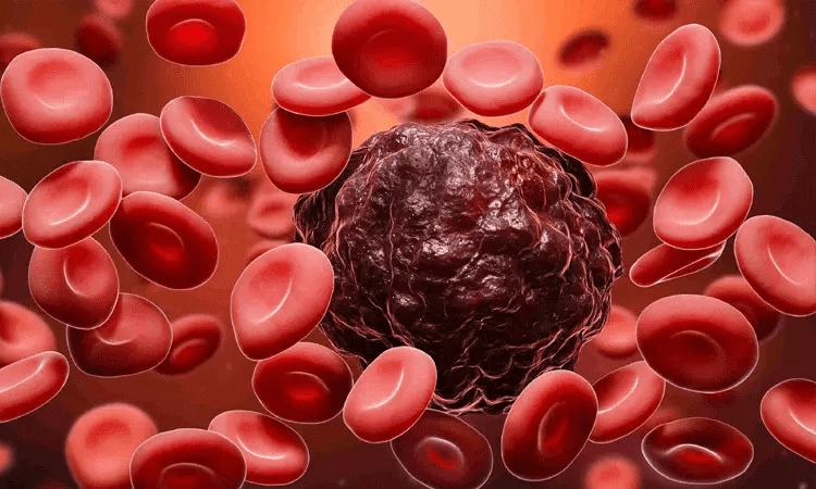 Early Signs of Cancer