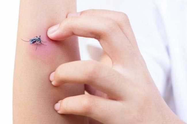 Mosquitoes : దోమ‌లు ఎక్కువ‌గా కుడుతున్నాయా?