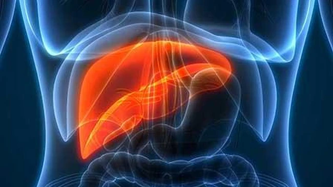 FattyLiver: భారత్‌లో పెరుగుతున్న MASLD కేసులు