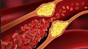 గుడ్ కొలెస్ట్రాల్ పెరగాలంటే ఇవి తినండి!