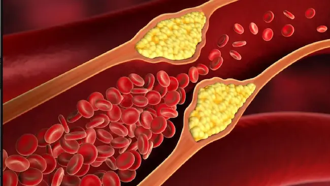 Healthy Living: గుడ్ కొలెస్ట్రాల్ పెరగాలంటే ఇవి తినండి!