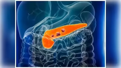 Health Alert: షుగర్ ఉన్నవారికి ప్యాంక్రియాస్ క్యాన్సర్ ముప్పు