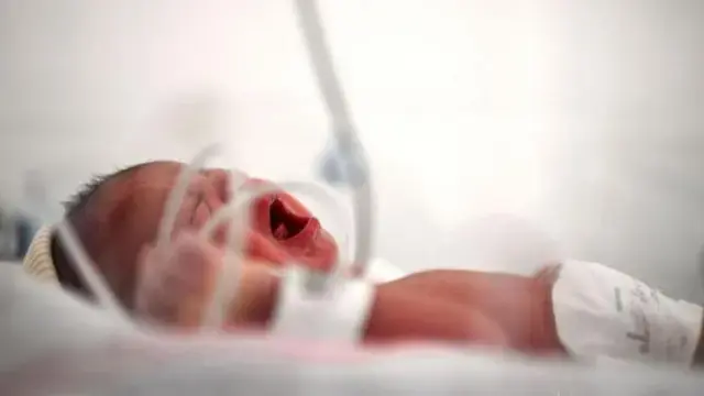 Newborn Care: ప్రీ మెచ్యూర్ బేబీలకు ఈ సమస్యల ముప్పు
